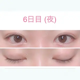 6日目の経過画像（2枚目）