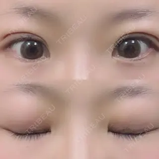 26日目の経過画像（1枚目）