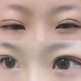 26日目の経過画像（2枚目）