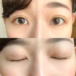 4日目の経過画像（1枚目）