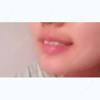 3日目の経過画像（2枚目）