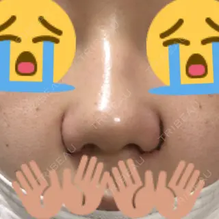 1日目の経過画像（1枚目）