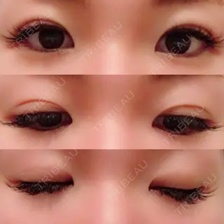 10日目の経過画像（1枚目）