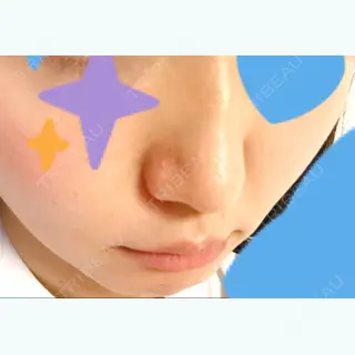 185日目の経過画像（3枚目）