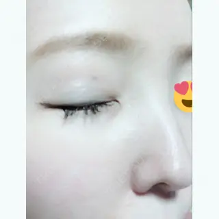 11日目の経過画像（2枚目）