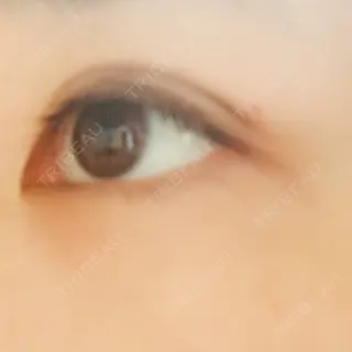 10日目の経過画像（2枚目）
