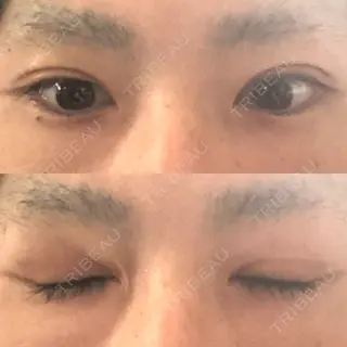 67日目の経過画像（1枚目）