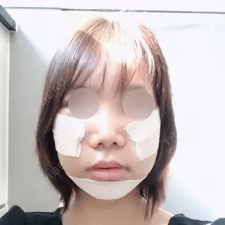 3日目の経過画像（1枚目）