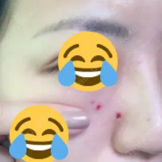 1日目の経過画像（1枚目）