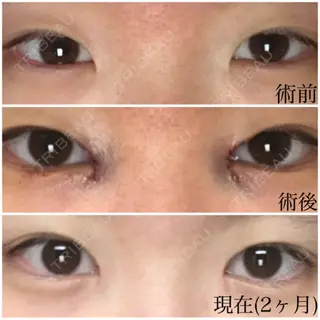 74日目の経過画像（2枚目）