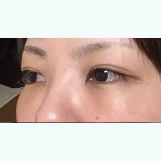 8日目の経過画像（2枚目）