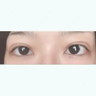 4日目の経過画像（1枚目）