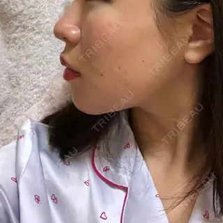 1日目の経過画像（3枚目）