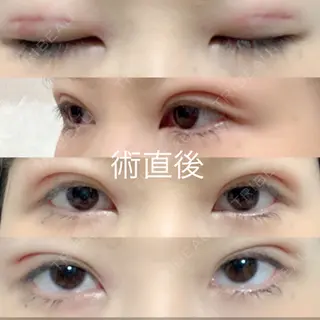 0日目の経過画像（1枚目）