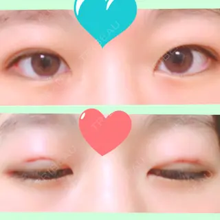 0日目の経過画像（1枚目）