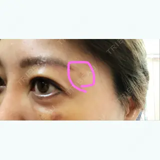8日目の経過画像（3枚目）