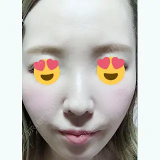15日目の経過画像（1枚目）