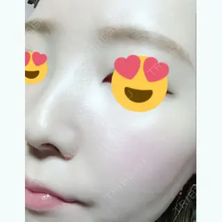 15日目の経過画像（3枚目）
