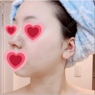 2日目の経過画像（2枚目）
