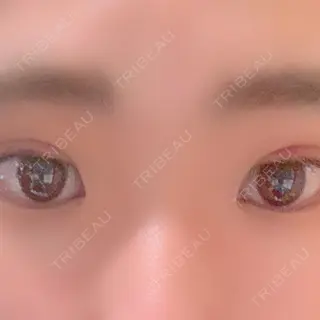 1日目の経過画像（1枚目）