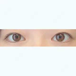 120日目の経過画像（1枚目）