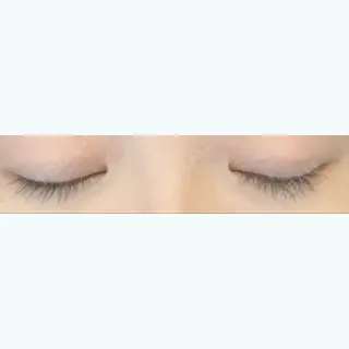120日目の経過画像（3枚目）