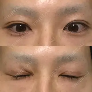 73日目の経過画像（1枚目）