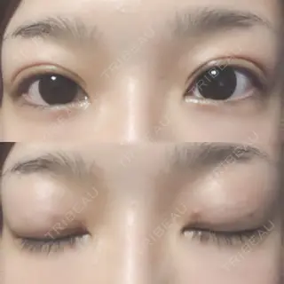 9日目の経過画像（1枚目）