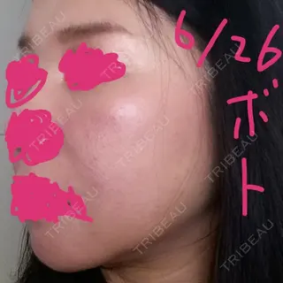 4日目の経過画像（3枚目）