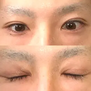 78日目の経過画像（1枚目）