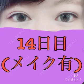 14日目の経過画像（1枚目）