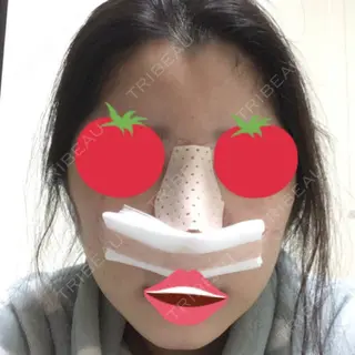 1日目の経過画像（1枚目）