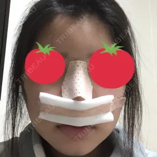 1日目の経過画像（1枚目）