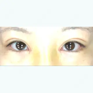 7日目の経過画像（1枚目）