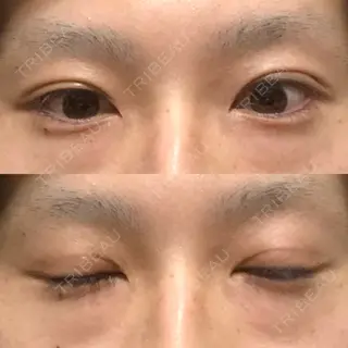 80日目の経過画像（1枚目）