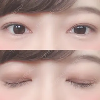 175日目の経過画像（1枚目）