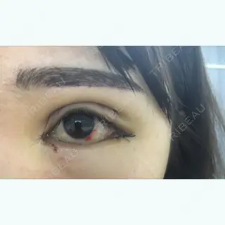3日目の経過画像（3枚目）