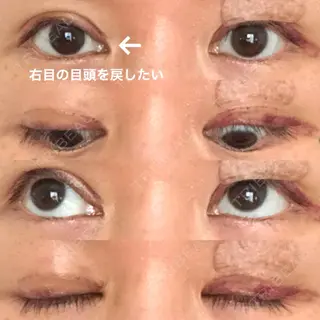 8日目の経過画像（1枚目）