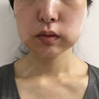 1日目の経過画像（1枚目）