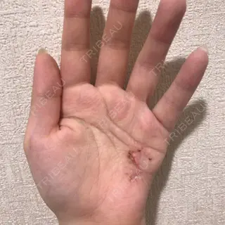 26日目の経過画像（1枚目）