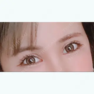 57日目の経過画像（1枚目）