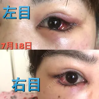 2日目の経過画像（2枚目）