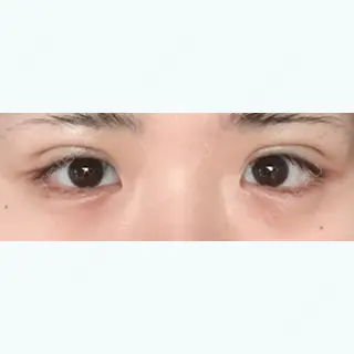 3日目の経過画像（1枚目）