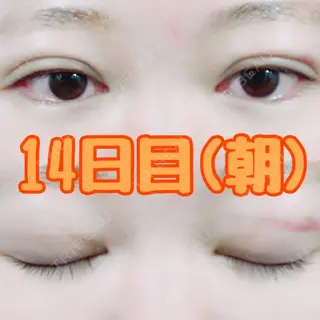 15日目の経過画像（1枚目）