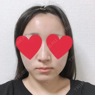 16日目の経過画像（1枚目）