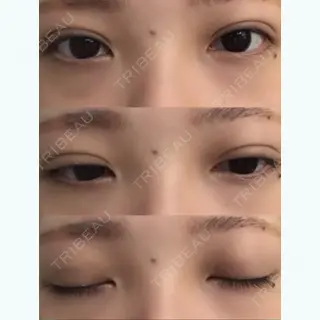 3日目の経過画像（1枚目）
