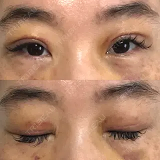 8日目の経過画像（1枚目）
