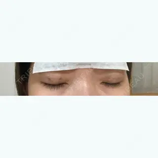 2日目の経過画像（2枚目）