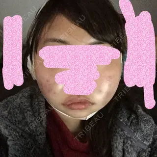 1日目の経過画像（1枚目）