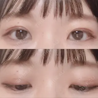20日目の経過画像（1枚目）